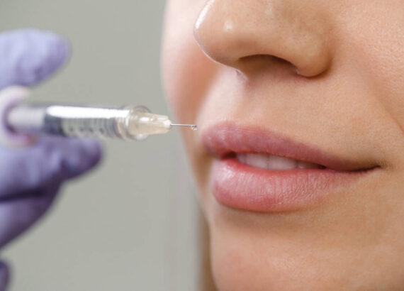 powiększania ust z kwasem hialuronowym
